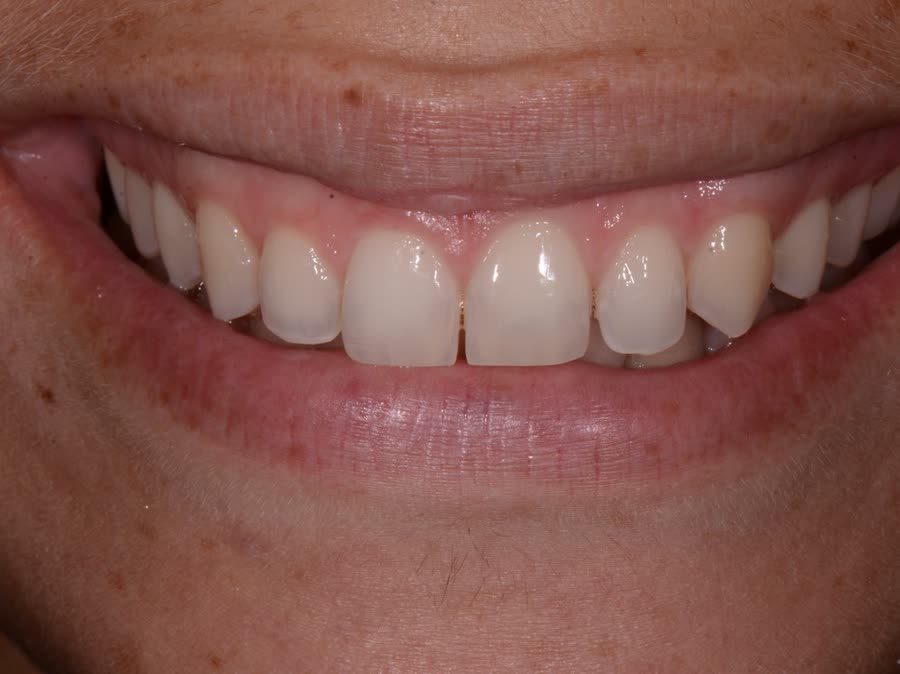 Case 4 — before