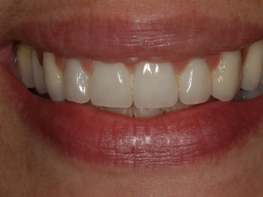 Case 5 — after