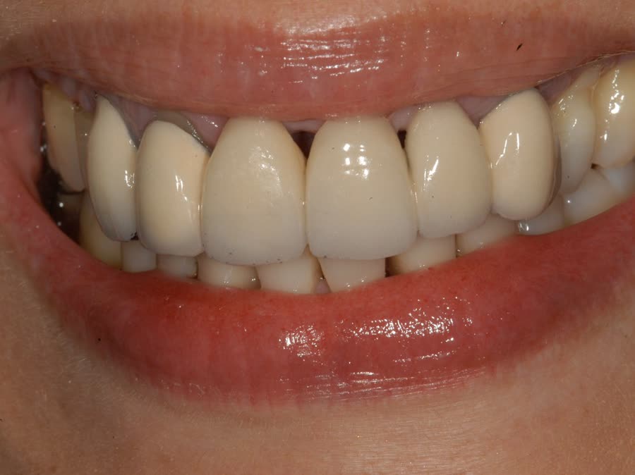 Case 5 — before