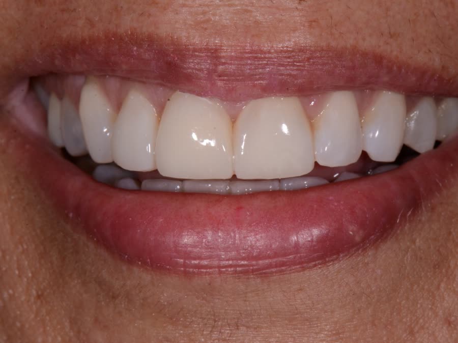 Case 6 — after