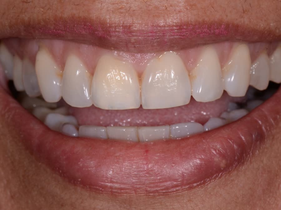 Case 6 — before