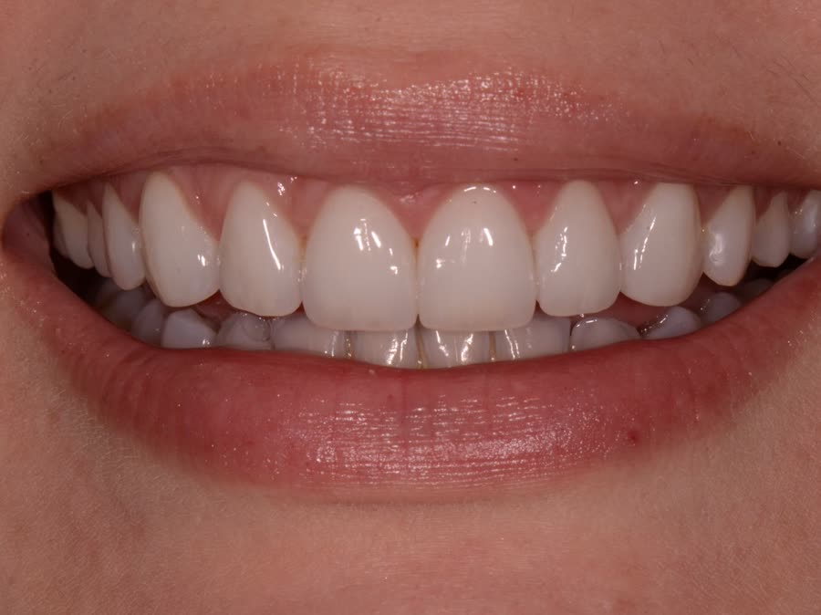 Case 7 — after