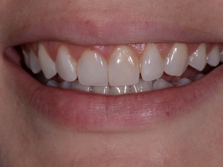 Case 7 — before