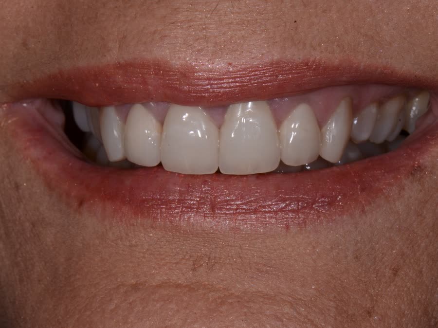 Case 8 — after