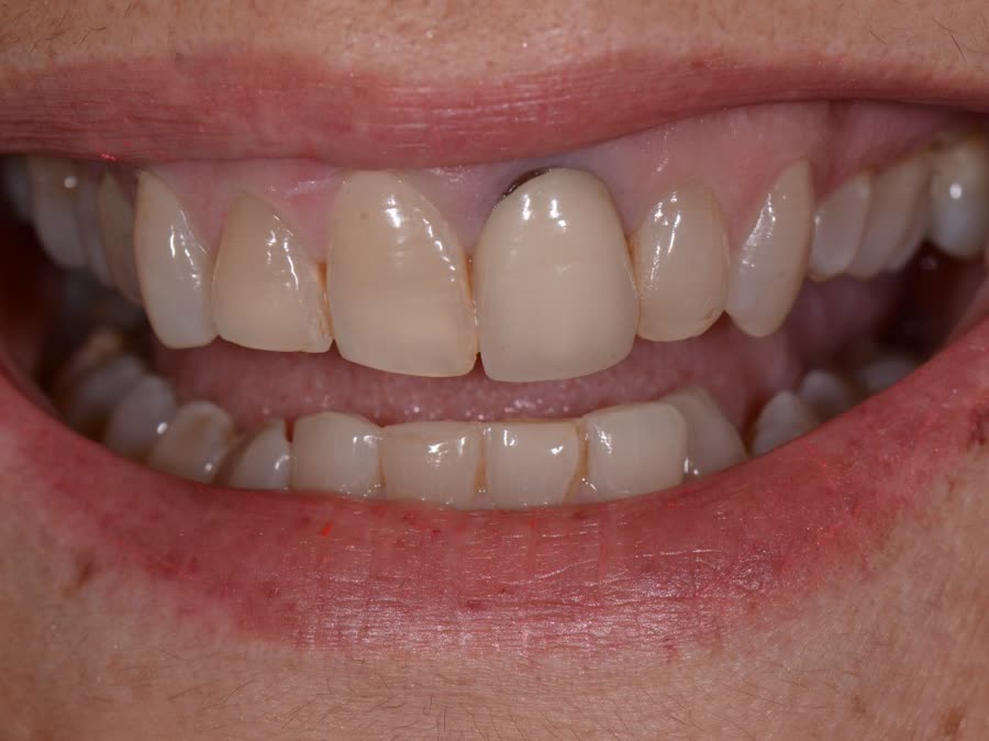 Case 8 — before