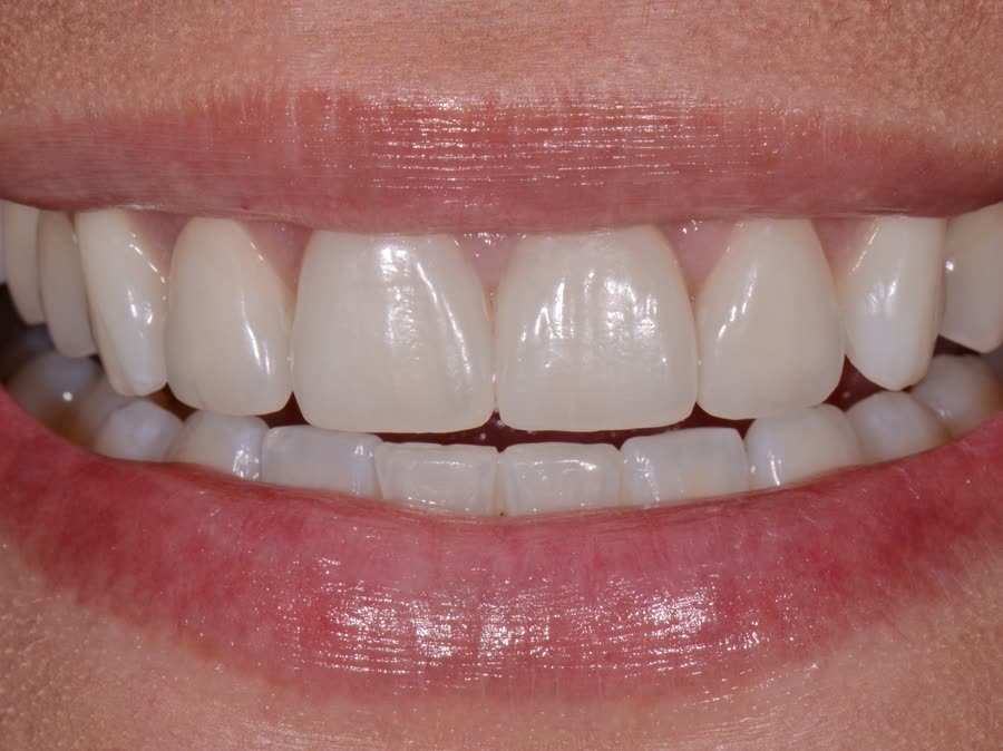 Case 9 — after
