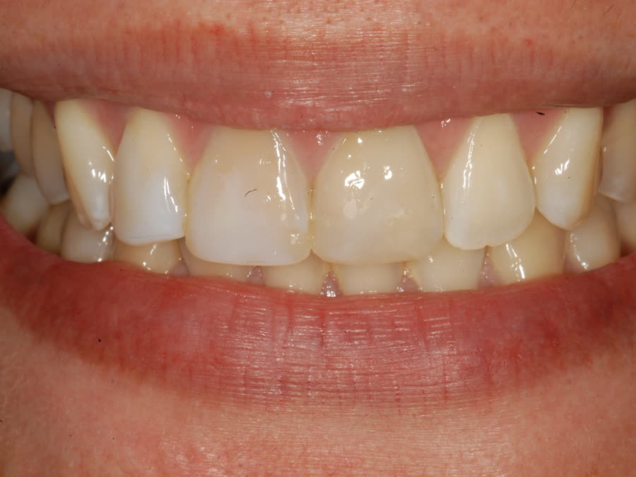 Case 9 — before