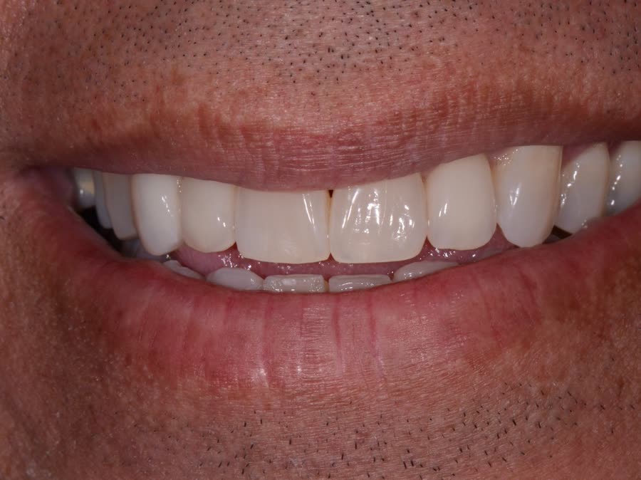 Case 10 — after