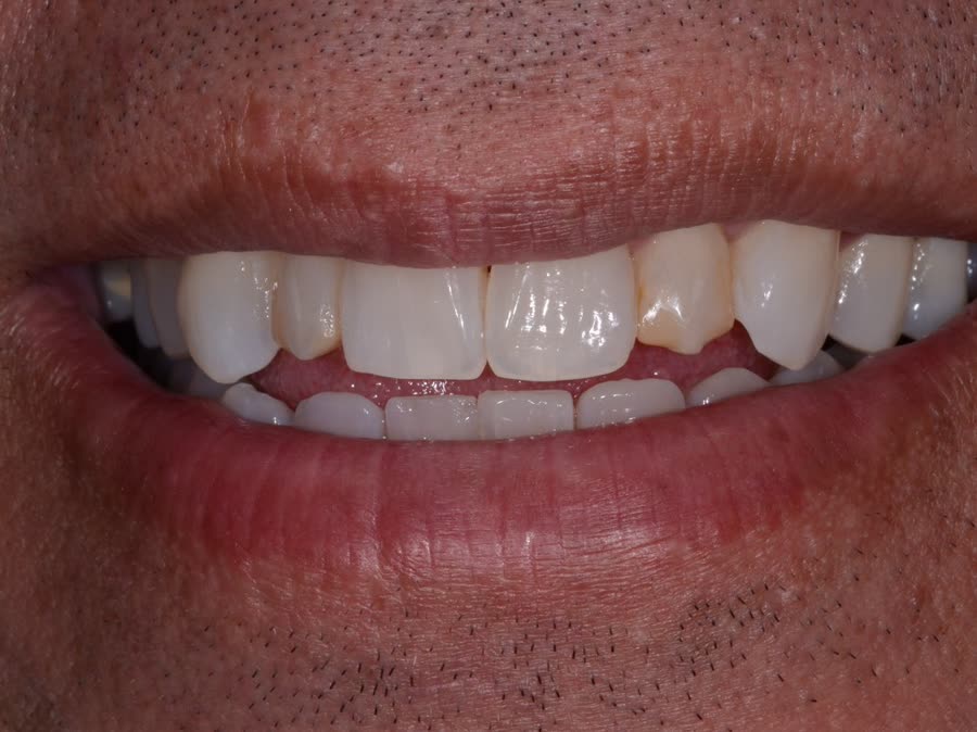 Case 10 — before