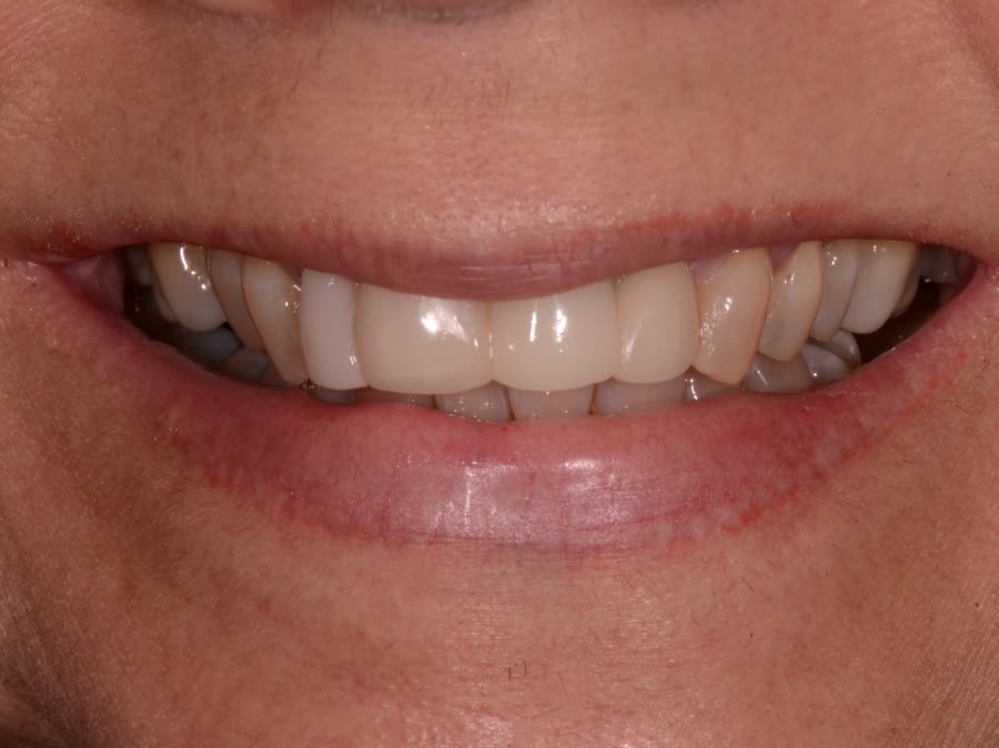 Case 11 — before