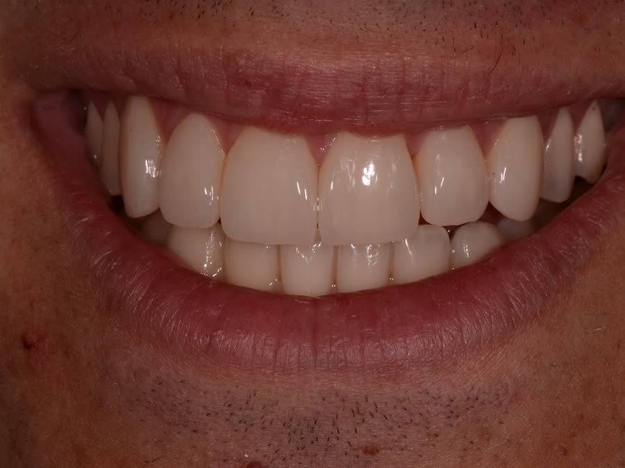 Case 12 — after