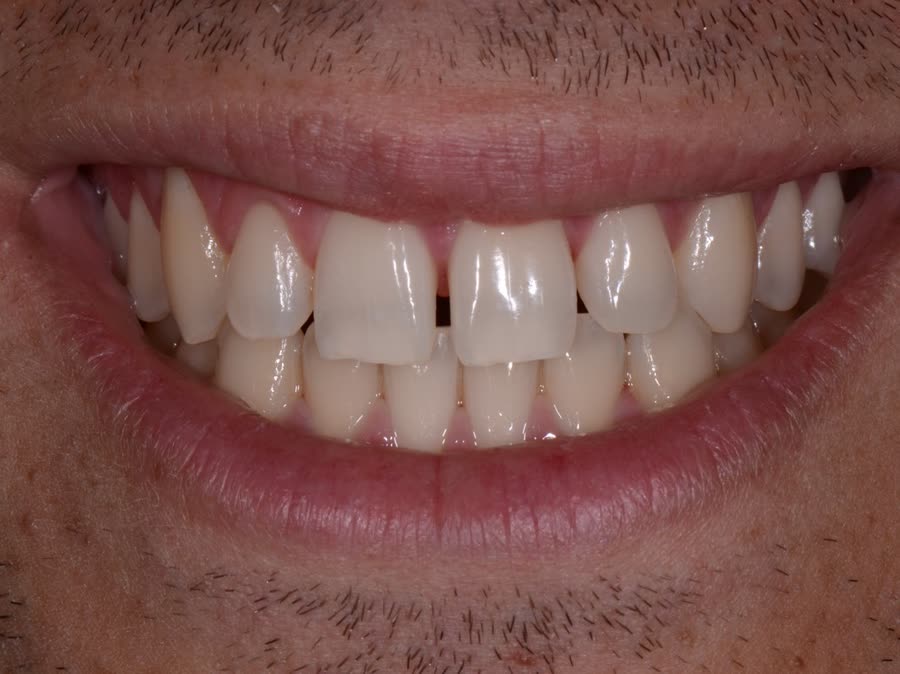 Case 12 — before